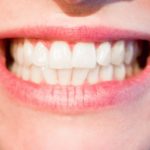 Nowoczesna technologia używana w salonach stomatologii estetycznej może sprawić, że odzyskamy śliczny uśmiech.